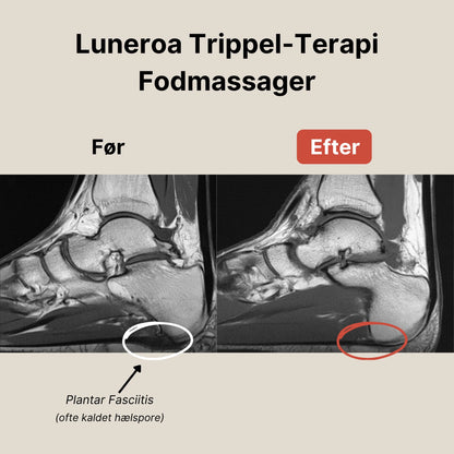 Luneroa Trippel-Terapi Fodmassager